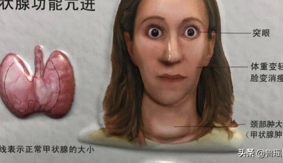 甲亢哥发现自己支持的队会输球，对明天阿根廷有了小巧思