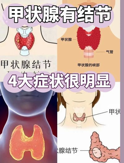 甲亢哥发现自己支持的队会输球，对明天阿根廷有了小巧思
